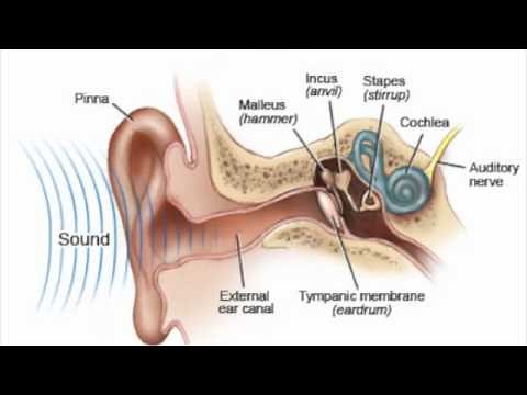 Auditory Neuropathy Spectrum Disorder Simulation