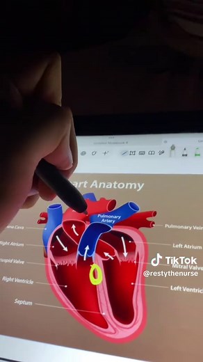 Cyanotic vs Acyanotic Heart Disease Explained