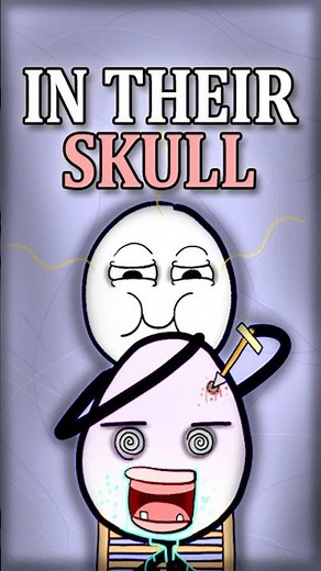 They Drilled Holes Into People's Skulls 🧠😨 #history #darkhistory #facts #disturbing #didyouknow