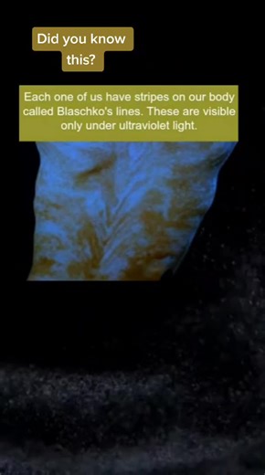 Humans with Stripes: Discovering Blaschko Lines