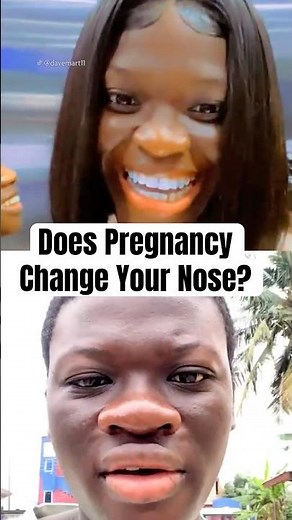 Does Pregnancy Change Your Nose? #shorts #tiktoktrend #PregnancyNose