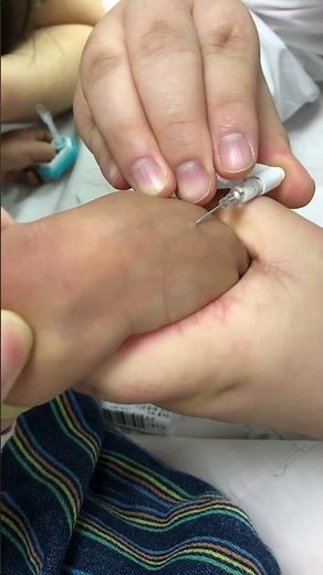 "What to Expect During an Infant Blood Draw or IV Start"