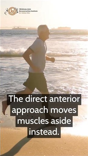 Direct Anterior Hip Replacement: Why a Muscle-Sparing Approach Matters