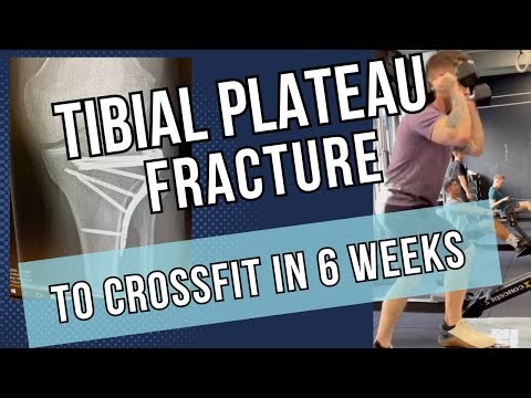 Tibial Plateau Fracture Flexion Exercise - Start this from Week One!