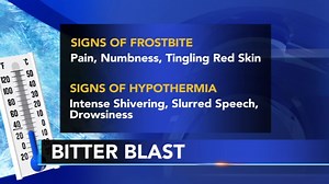 How to spot and treat frostbite, other winter health risks