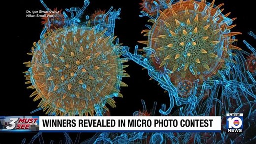 Results from micro photo contest are quite astounding
