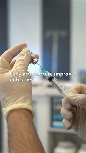 Frozen Shoulder Early Signs