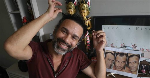 Transplante capilar: técnica que contorna efeitos da calvície ajuda a recuperar a autoestima; vídeo