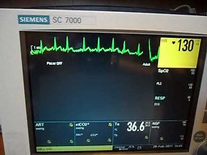 Siemens SC7000 VF (simulated)