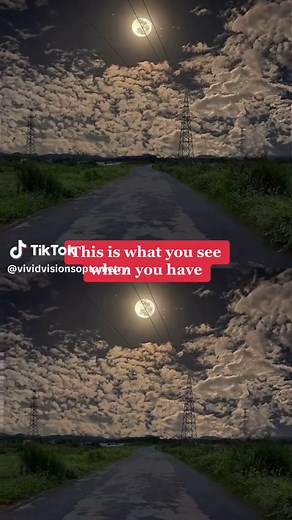 This is what you see when you have: Oscillopsia is a vision problem in which still objects seem to jump, jiggle, or vibrate due to a misalignment of the eyes or systems controlling balance. #oscillopsia #shakyvision #vision #howisee #howpeoplesee #bvd #binocularvisionmatters #nystagmus - video from @zayn🍃
