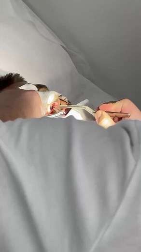 Ear Treatment for Dogs: Removing Objects Safely