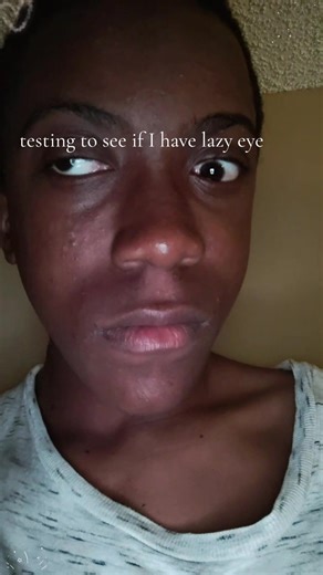 Lazy Eye Fun: Hilarious Memes and Moments