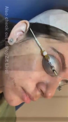 Full : https://emmeacne.com/?p=3823 | Mr. PopZit