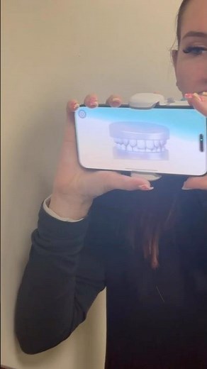 How to scan with the new version of dental monitoring :)