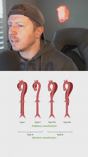 Aortic Dissections: Know the Classifications! Aortic dissection = time is life. Recognizing the type helps guide treatment. 🚑 🔹 Stanford Type A – Involves the ascending aorta (with or without descending involvement). Surgical emergency! 🔹 Stanford Type B – Involves only the descending aorta. Usually managed medically unless complications arise. 🔹 DeBakey Type I – Starts in the ascending aorta and extends to the descending aorta. 🔹 DeBakey Type II – Confined to the ascending aorta. 🔹 DeBake