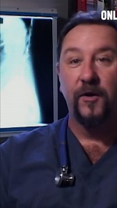 Doctors share some of the strangest objects they've encountered inside patients. From lighters to light bulbs, the stories are shocking. Did you know Christmas Eve sees a spike in these incidents? #medicalcases #emergencyroom #oddstories #healthfacts | Only Human