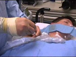 Central Line Insertion - Part III: Insertion • Video • MEDtube.net