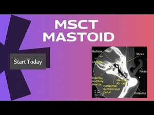 Teknik Pemeriksan CT Scan Mastoid/telinga/Aircell