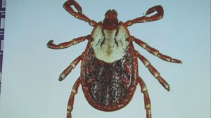 Avoid ticks to avoid 'crushing' disease: 'It just ruined my life'