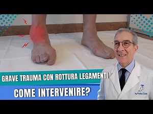 Rottura dei legamenti della caviglia e artrosi. | Dott. Andrea Scala