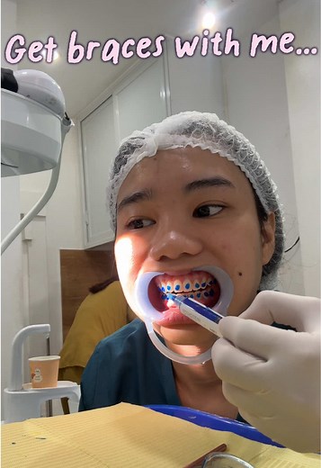 Get braces with me? — Braces installation and costs in the Philippines