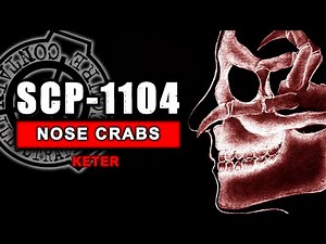SCP-1104 - The Nose Crabs