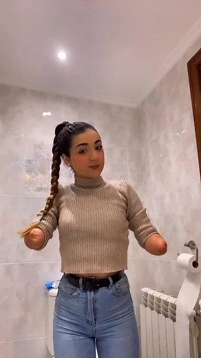 Empowering Amputee Women: Inspiring Stories and Videos