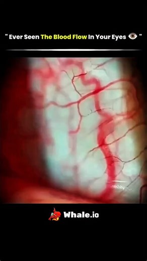 @solved_science on Instagram: "The human eye contains a dense network of capillaries that transport oxygen and nutrients to retinal tissues. Using advanced imaging techniques, scientists can now visualize this microscopic blood flow, helping diagnose eye diseases and monitor overall vascular health effectively. #everseen #bloodflow #eyes #tech #knowledge #technology #history #usa #innovation #fyp #viral #didyouknow #reels"