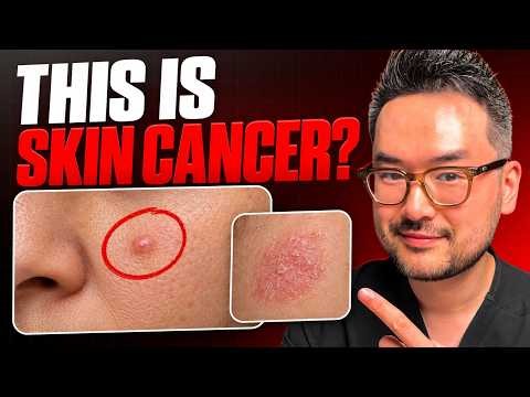 Skin Cancer Doesn’t Look Like You Think — A Dermatologist Explains | Dr. Danny Guo