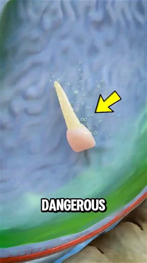 Swallowed Your Tooth? 😨 Here’s What REALLY Happens