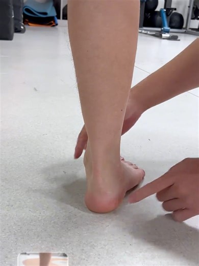 Best Arch Support Insoles for Fallen Arches