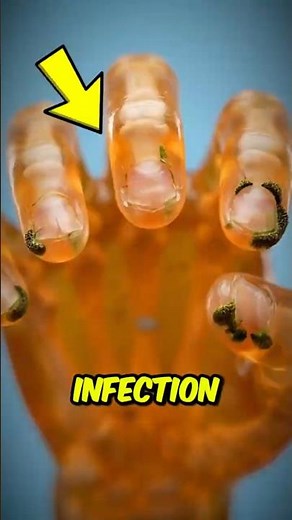 What Happens If You Bite Your Nails‼️😱