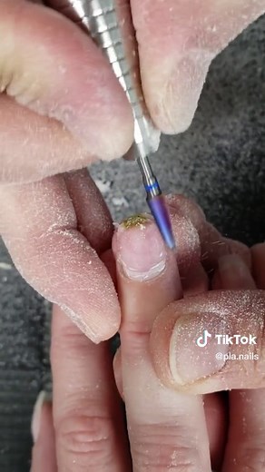How to Treat Green Nails: Nail Repair and Prevention Guide