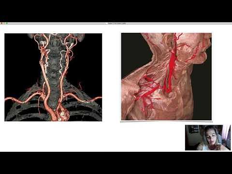 Arteries of the Neck and Head
