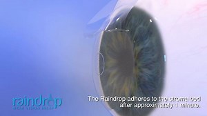 Raindrop eye procedure