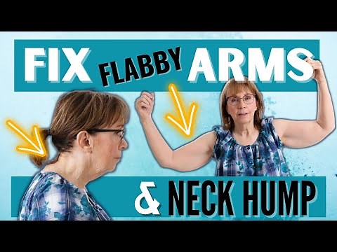 How to fix Neck Hump and Flabby Bat Wings (Challenge)