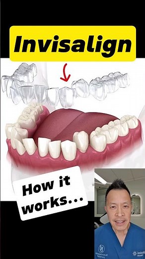 How Invisalign Straightens Your Teeth: Easy Explanation! #dentallan #dentist #shorts