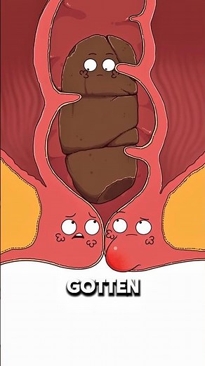 Why Constipation Can Cause Hemorrhoids 😬..!!#e2dhealth #animation #2dshow #fypシ #health