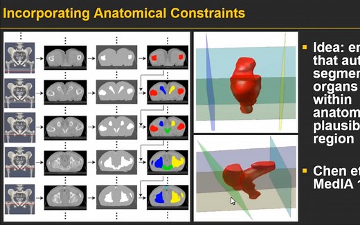 Statistical Shape Model基础-数字图像处理课程Active shape models
