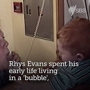 14K views · 44 reactions | Meet the exceptional people who are helping international scientists make medical breakthroughs and advance knowledge of the human body. The World's Most Extraordinary People, Monday 8.30PM on SBS. | SBS Australia | Facebook