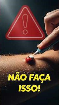 O jeito CERTO de tratar picada de vespa (segundo a ciência)
