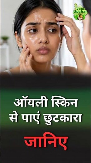 Say Goodbye to Oily Skin with These Natural Tips | Vedic Upchar | @anilbansalayurveda | #oilyskin