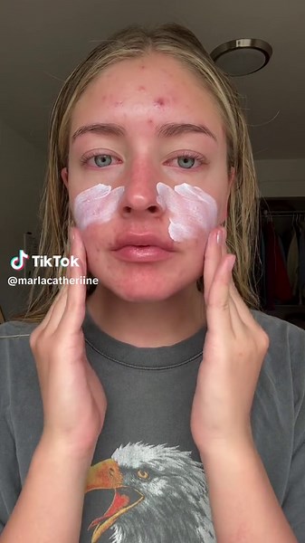 Best Acne Makeup Routine with Moisturizer, Sunscreen & More