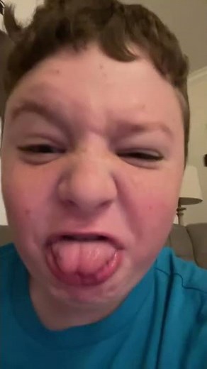 Jelly bean face Reveal￼!!! ￼