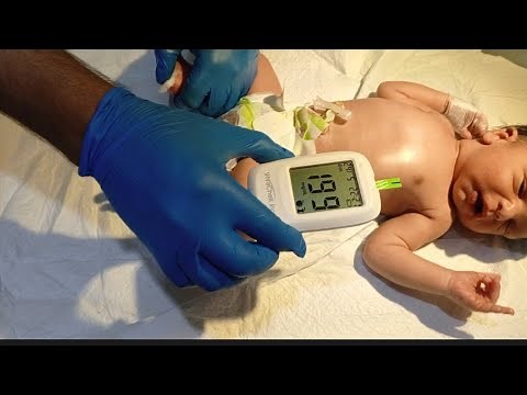 Checking RBS in a Neonate | Newborn Blood Sugar Test Procedure...