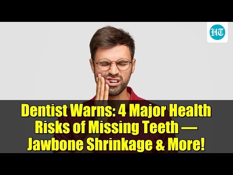 Dentist Warns: 4 Major Health Risks of Missing Teeth – Jawbone Shrinkage & More!