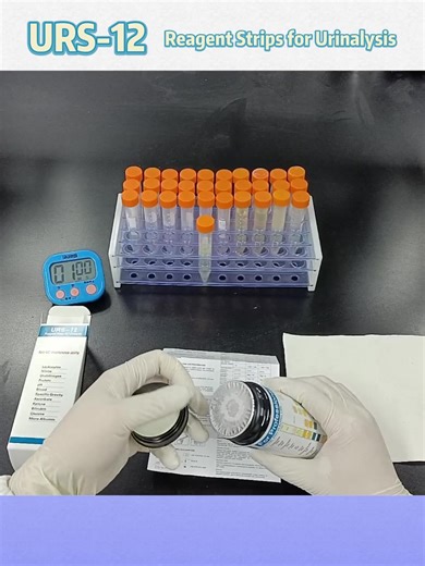 A Customizable Urine test Strip That Can Detect Twelve Data Points Urine test Strips