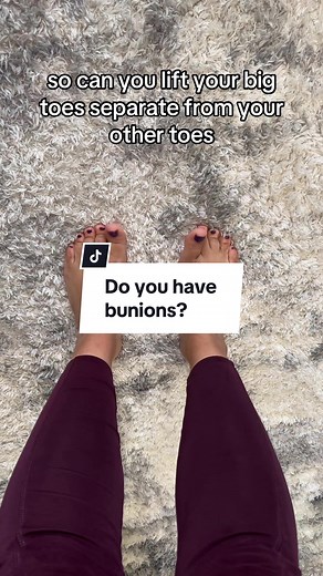 Improve Your Bunion Pain with Toe Mobility Exercises