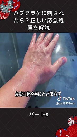 ハブクラゲに刺されたら？正しい応急処置を解説 #ベニテングタケ #きのこ #検証 #注意喚起 #パート3