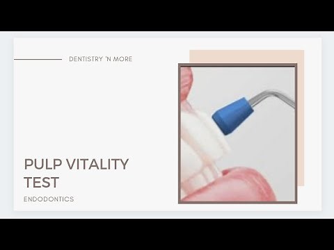 PULP VITALITY TESTS
